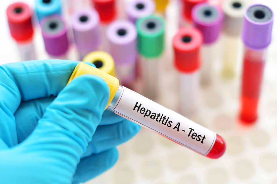 Hepatit A Nedir? Nasıl Bulaşıyor?