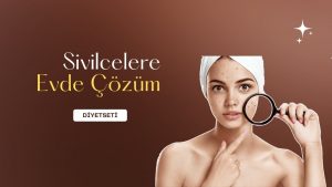 Sivilcelere Evde Çözüm 1 Sivilcelere Evde Çözüm